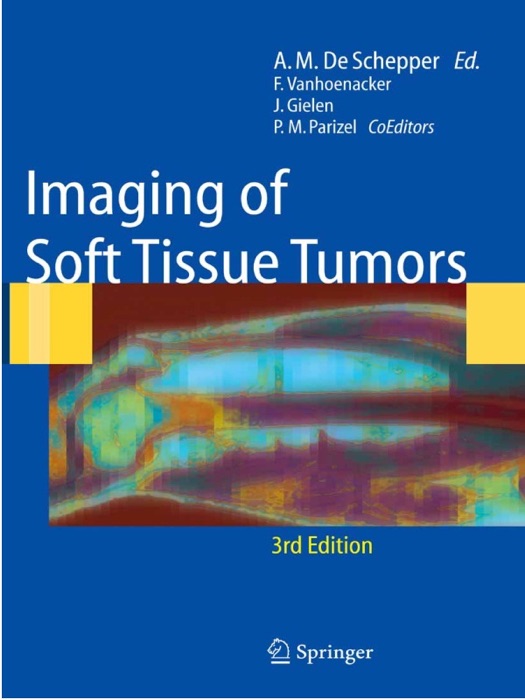 Imaging of Soft Tissue Tumors