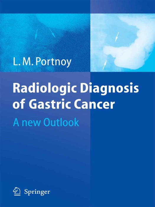 Radiologic Diagnosis of Gastric Cancer