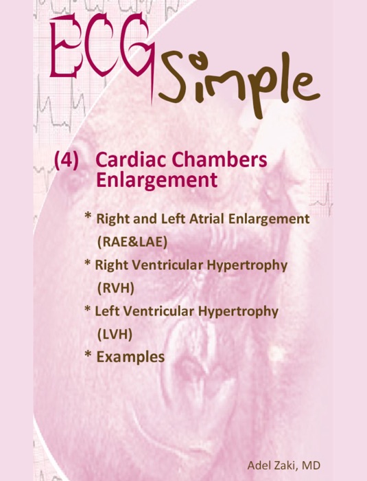 ECG Simple (4) Cardiac Chambers Enlargement