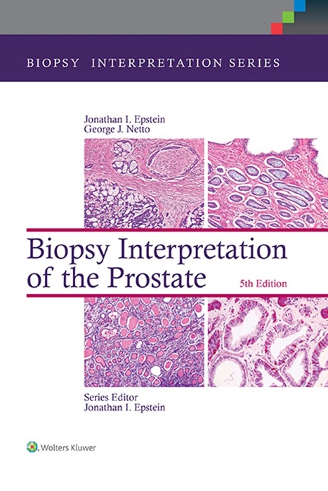 Biopsy Interpretation Series: Biopsy Interpretation of the Prostate: 5th Edition