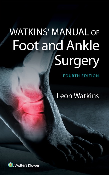 Watkins’ Manual of Foot and Ankle Surgery