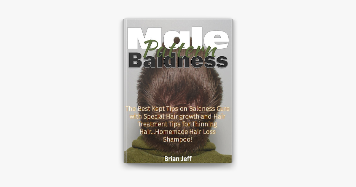 Male Pattern Baldness The Best Kept Tips On Baldness Cure With