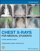 Chest X-Rays for Medical Students - Christopher Clarke & Anthony Dux