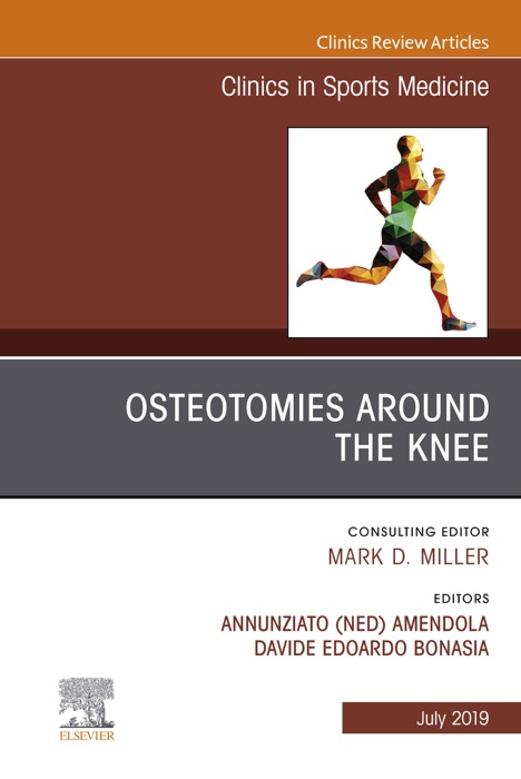 Osteotomies Around the Knee, An Issue of Clinics in Sports Medicine, Ebook