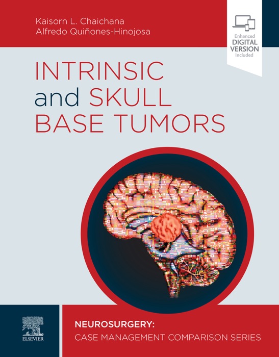 Intrinsic and Skull Base Tumors - E-Book