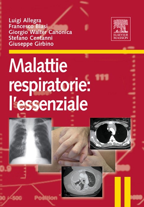 Malattie repiratorie. L'essenziale