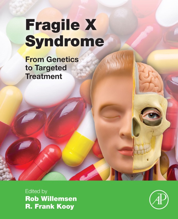 Fragile X Syndrome