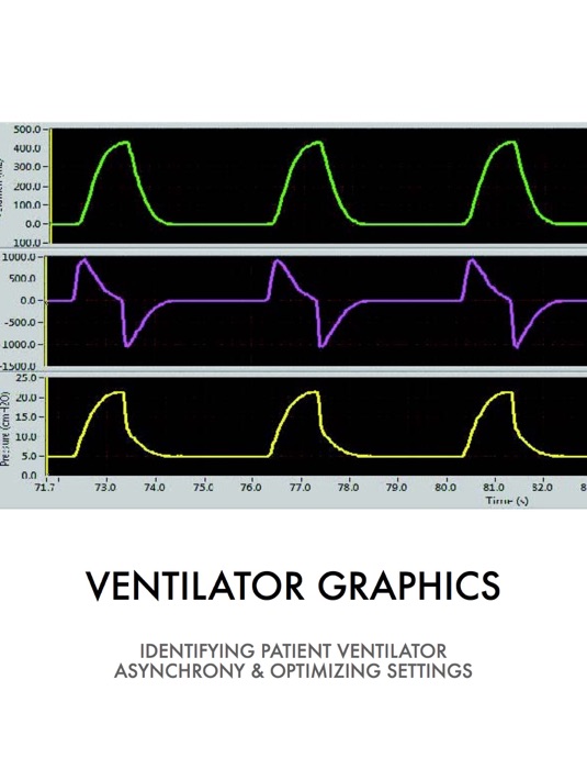 Ventilator Graphics