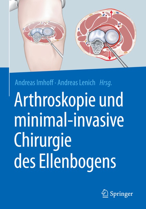 Arthroskopie und minimal-invasive Chirurgie des Ellenbogens