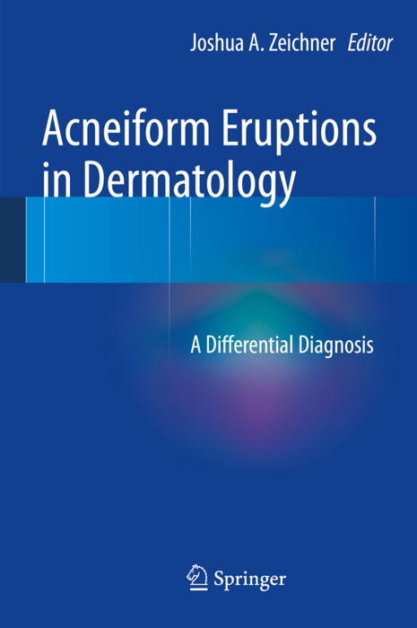 Acneiform Eruptions in Dermatology