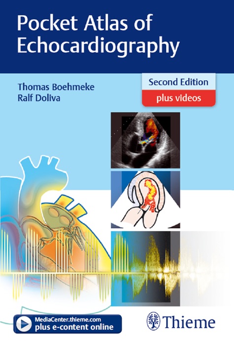 Pocket Atlas of Echocardiography