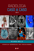 Radiologia caso a caso 2015 - Ricardo Mello