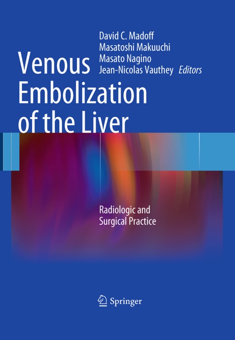 Venous Embolization of the Liver