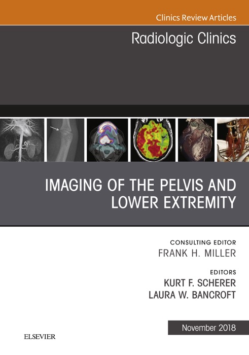 Imaging of the Pelvis and Lower Extremity, An Issue of Radiologic Clinics of North America E-Book