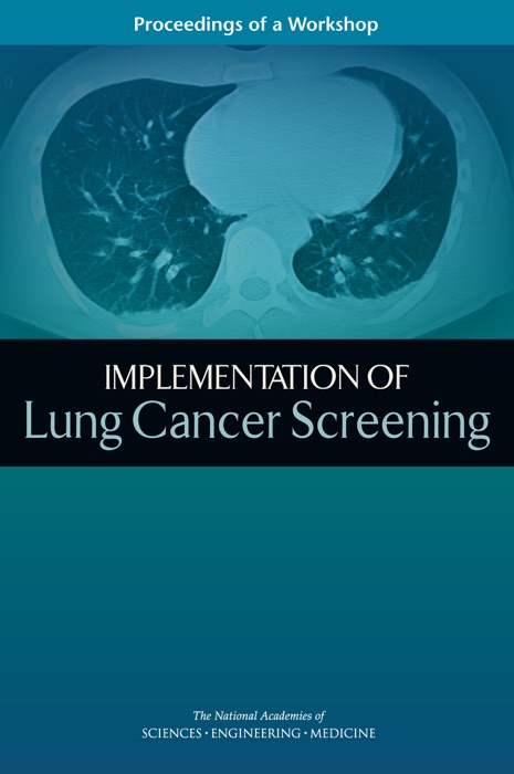 Implementation of Lung Cancer Screening