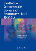 Handbook of Cerebrovascular Disease and Neurointerventional Technique - Mark R. Harrigan & John P. Deveikis