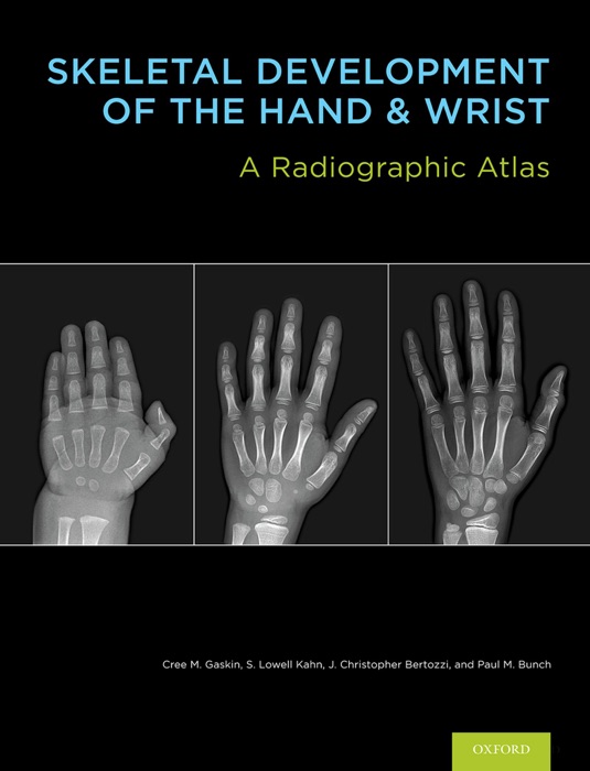 Skeletal Development of the Hand and Wrist