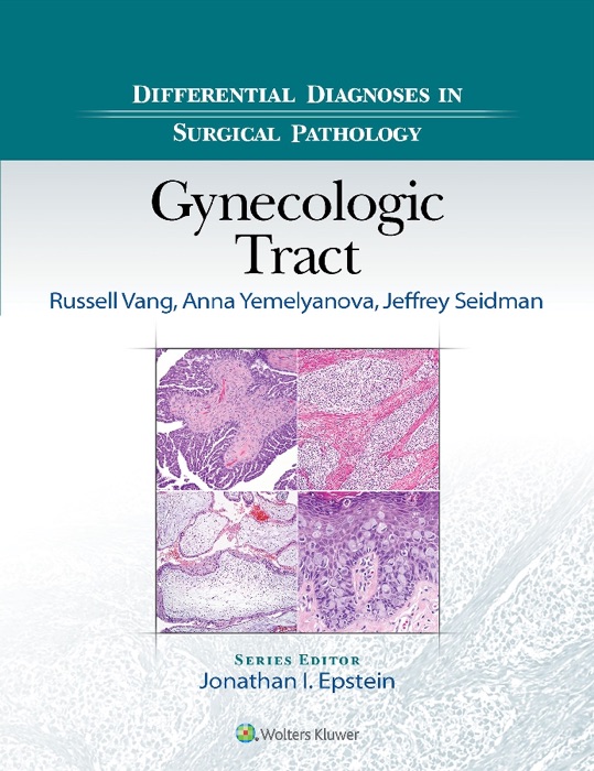 Differential Diagnoses in Surgical Pathology