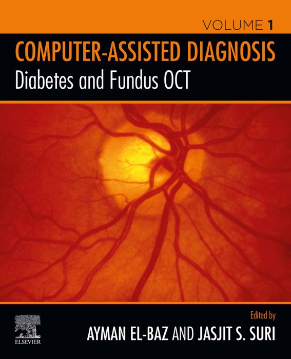 Diabetes and Fundus OCT (Enhanced Edition)