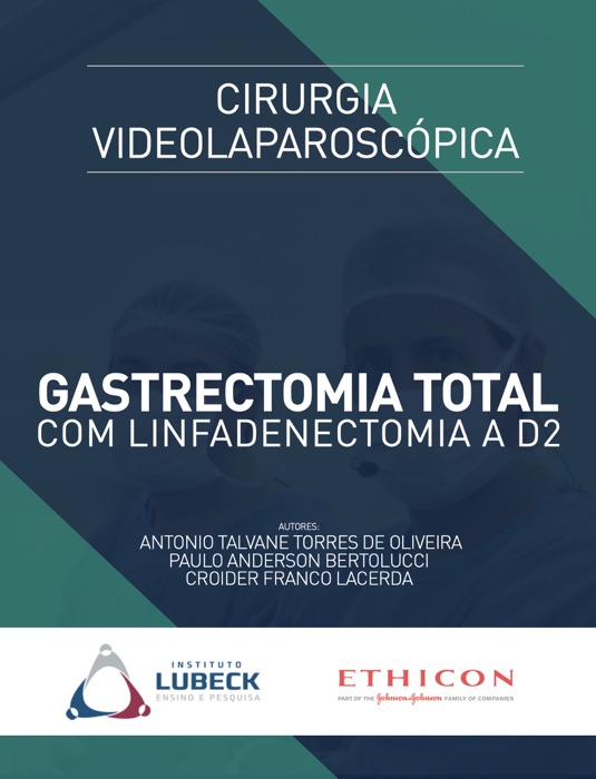 Cirurgia Videolaparoscópica: Gastrectomia Total com Linfadenectomia a D2