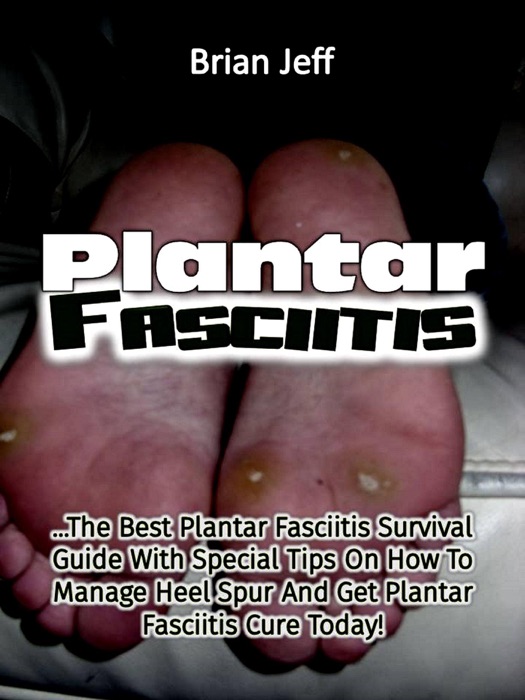 Plantar Fasciitis: The Best Plantar Fasciitis Survival Guide With Special Tips On How To Manage Heel Spur And Get Plantar Fasciitis Cure Today!