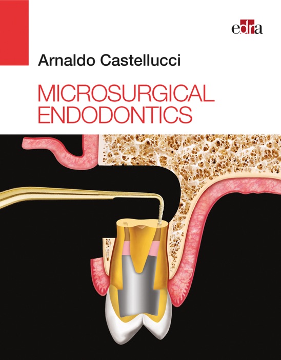 Microsurgical Endodontics