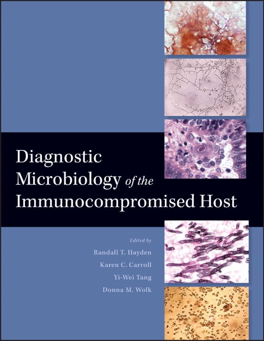 Diagnostic Microbiology of the Immunocompromised Host