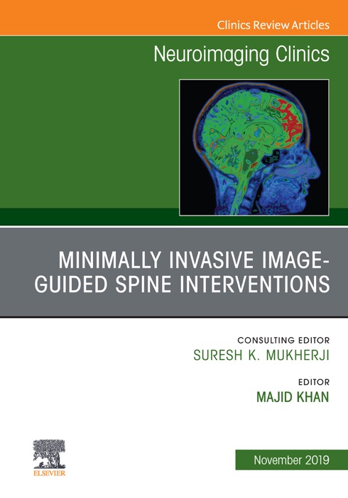 Spine Intervention, An Issue of Neuroimaging Clinics of North America, Ebook