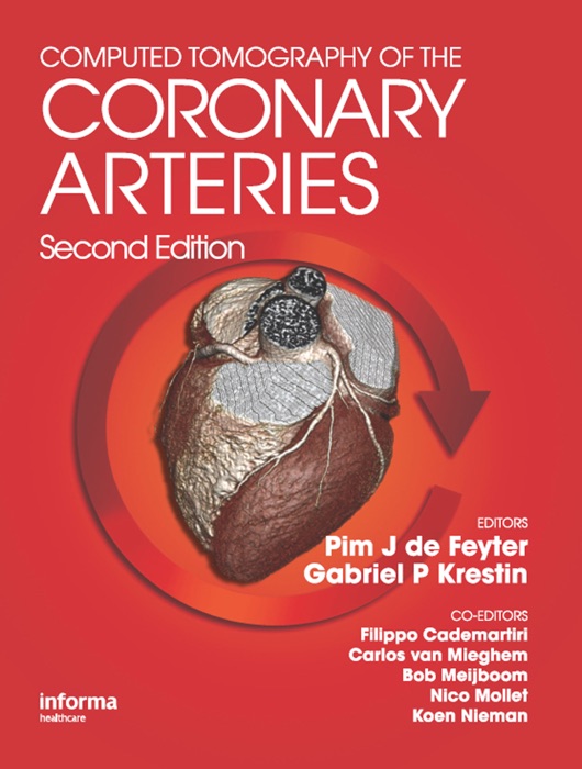 Computed Tomography of the Coronary Arteries