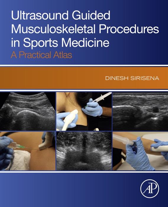 Ultrasound Guided Musculoskeletal Procedures in Sports Medicine