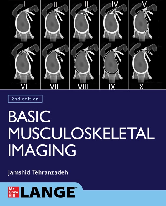 Basic Musculoskeletal Imaging, Second Edition