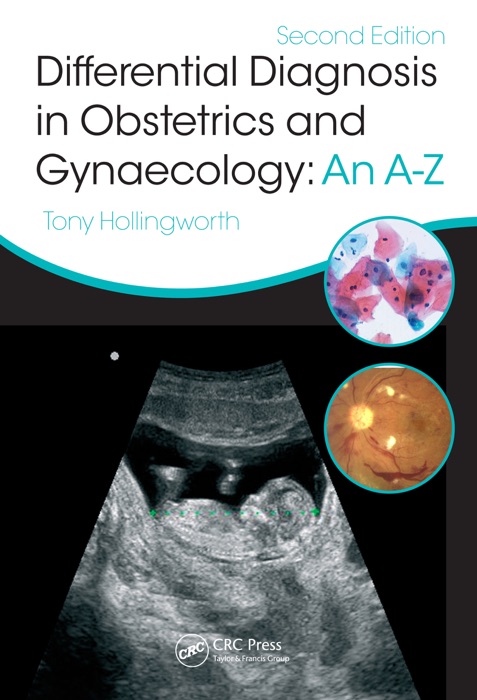 Differential Diagnosis in Obstetrics & Gynaecology