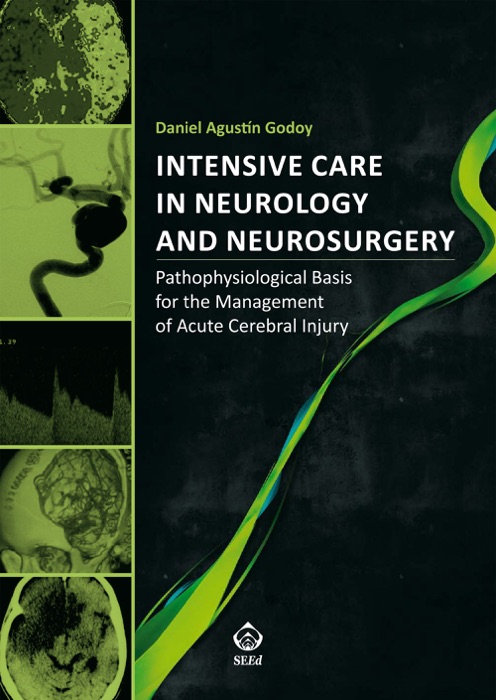 Intensive Care in Neurology and Neurosurgery