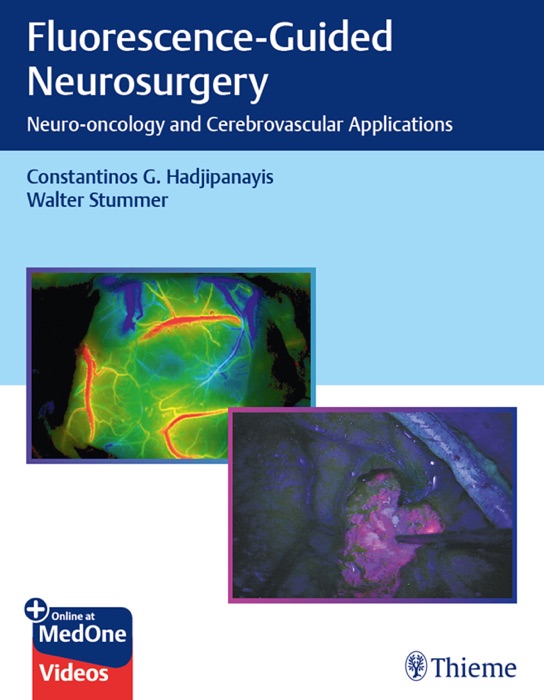 Fluorescence-Guided Neurosurgery