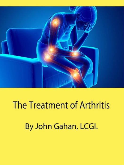 The Treatment of Arthritis