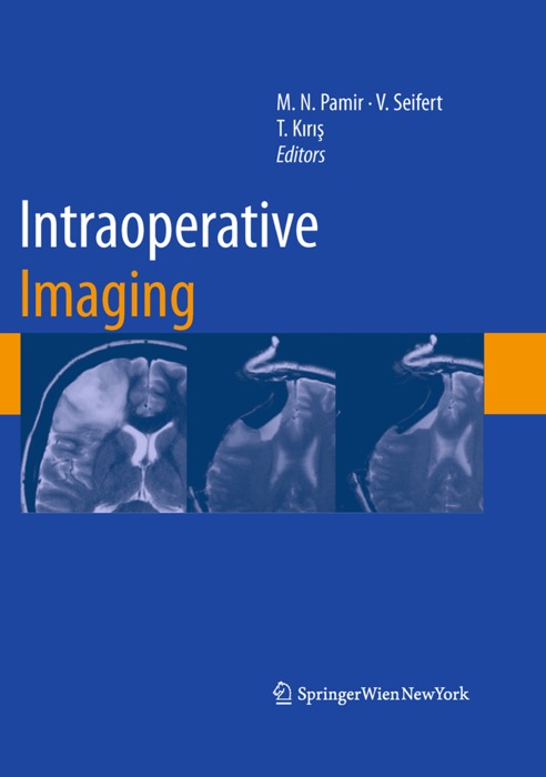 Intraoperative Imaging