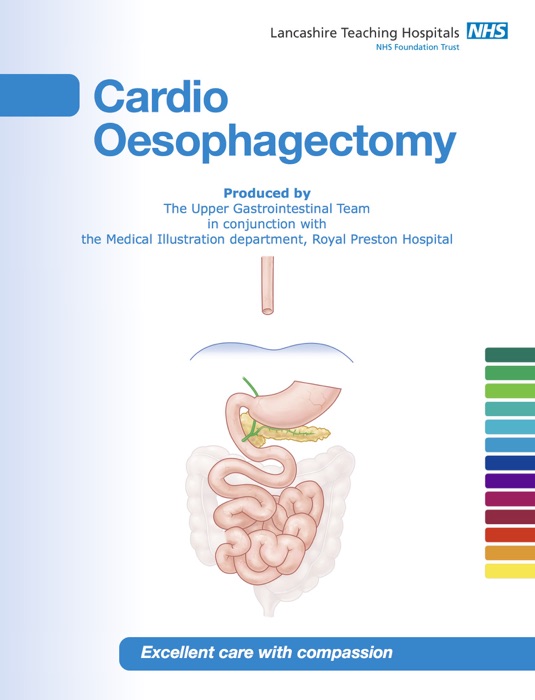 Cardio Oesophagectomy