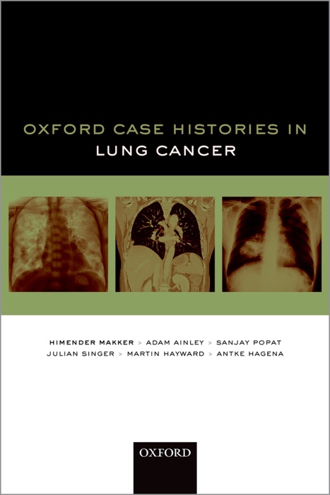 Oxford Case Histories in Lung Cancer