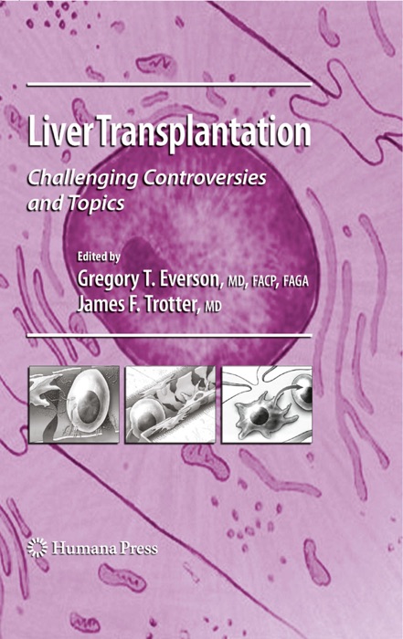 Liver Transplantation