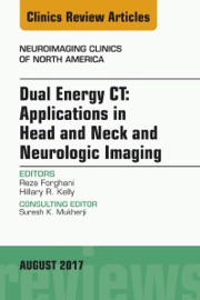 Dual Energy Ct Applications In Head And Neck And Neurologic Imaging An Issue Of Neuroimaging Clinics Of North America E Book