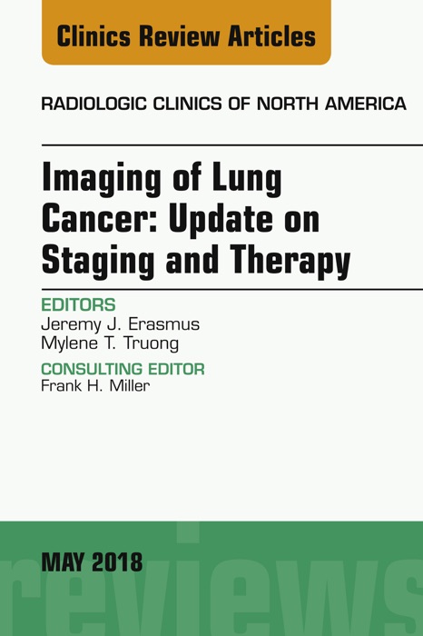 Lung Cancer, An Issue of Radiologic Clinics of North America, E-Book