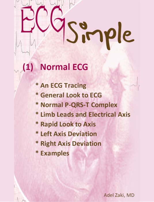 ECG Simple (1) Normal ECG