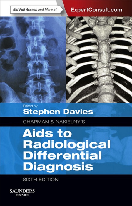 Chapman & Nakielny's Aids to Radiological Differential Diagnosis