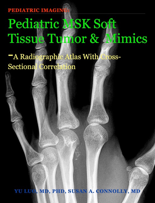 Pediatric Musculoskeletal (MSK) Soft Tissue Tumor and Mimics