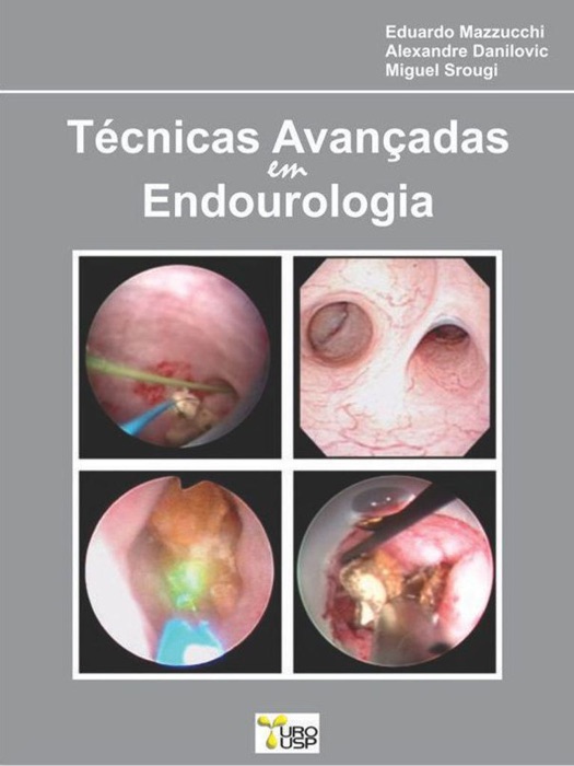 Técnicas Avançadas em Endourologia