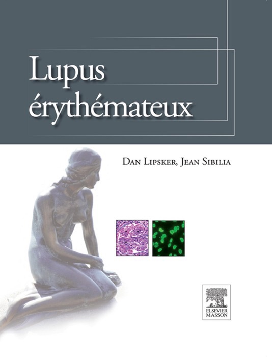 Lupus érythémateux