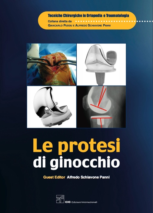 Le protesi di ginocchio