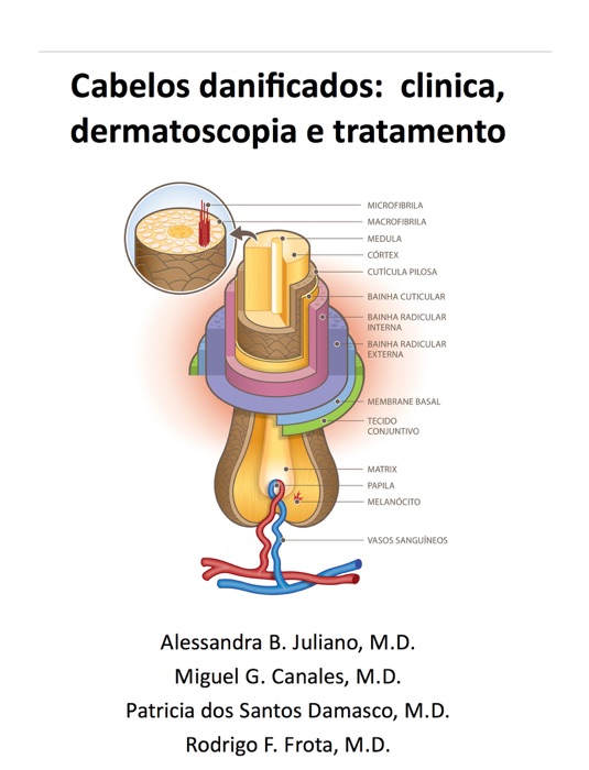 Cabelos danificados: Clinica, dermatoscopia e tratamento