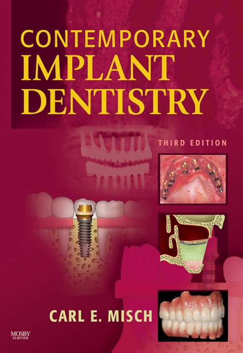 ARABIC-Contemporary Implant Dentistry