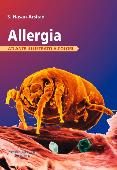 Allergia